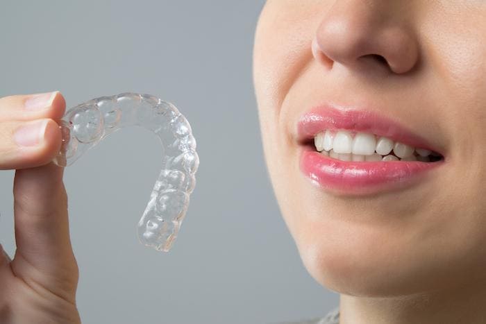 invisalign-noida