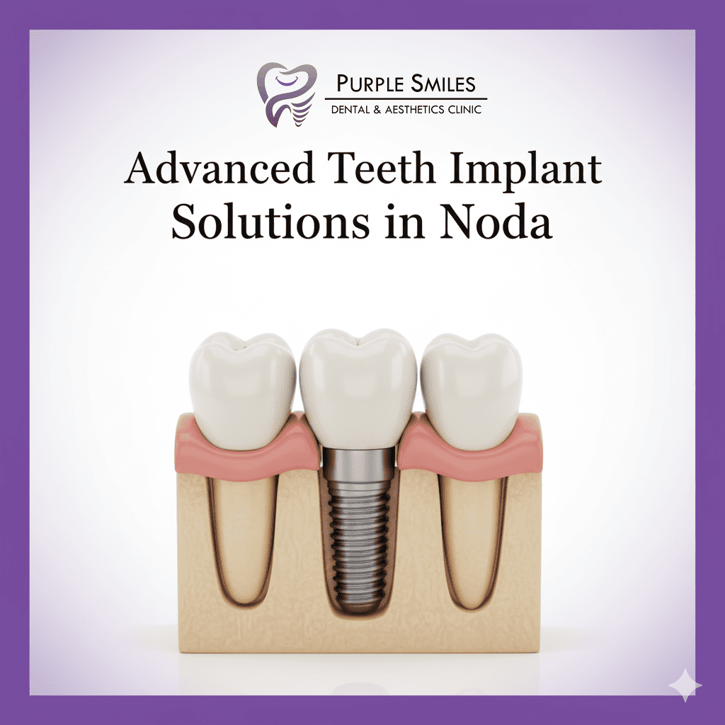 Teeth Implant Near Me
